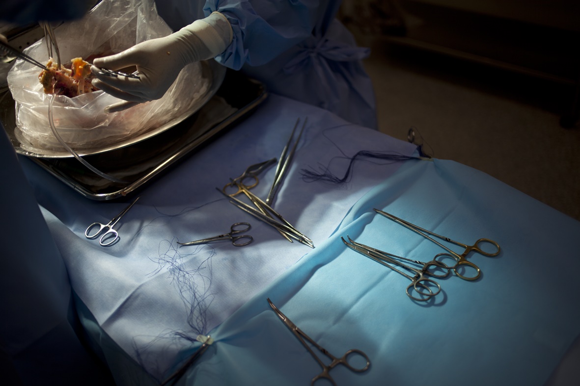 As mãos da enfermeira assistente se movem com rapidez e constância, oferecendo os instrumentos aos cirurgiões sem que eles tenham sequer que olhar para ela