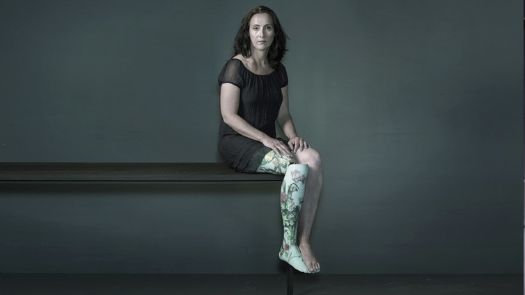 Kiera Roche usa uma perna de porcelana com motivos florais desenvolvida pela Altlimpro. Foto de Rosemary Williams e Nadav Kander