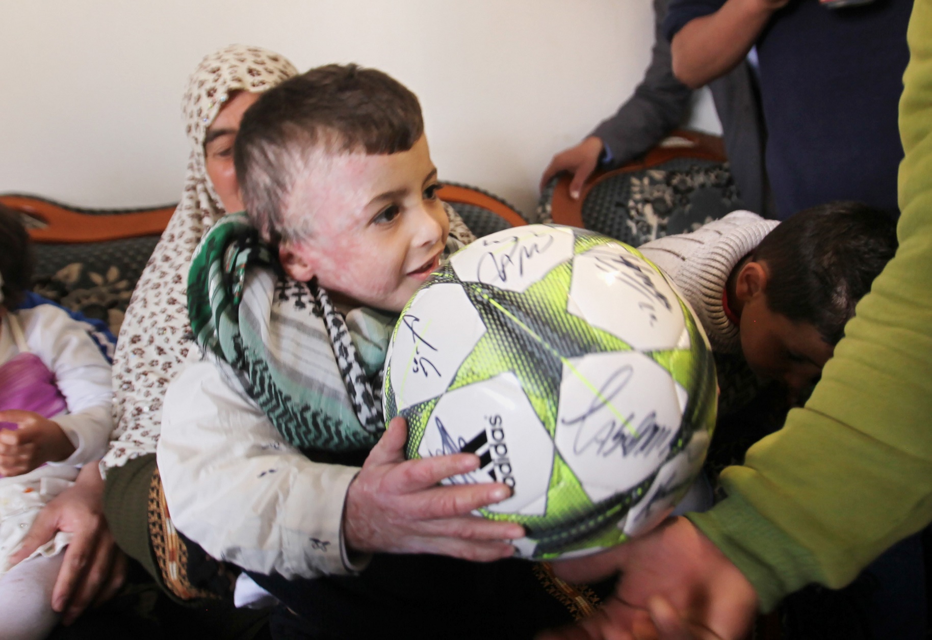 O menino palestino Ahmed Dawabsheh, fã do Real Madrid, perdeu os pais e o irmão após um ataque terrorista. Foto de Nedal Eshtayah / Anadolu Agency