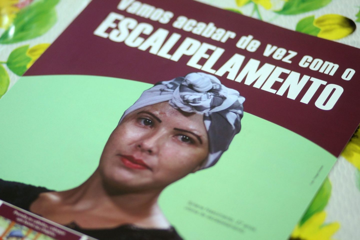 Em 2016, foram registrados seis acidentes por escalpelamento nos rios do Pará. Foto Thiago Gomes/Agência Pará