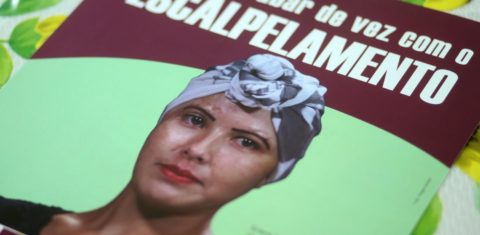 Em 2016, foram registrados seis acidentes por escalpelamento nos rios do Pará. Foto Thiago Gomes/Agência Pará