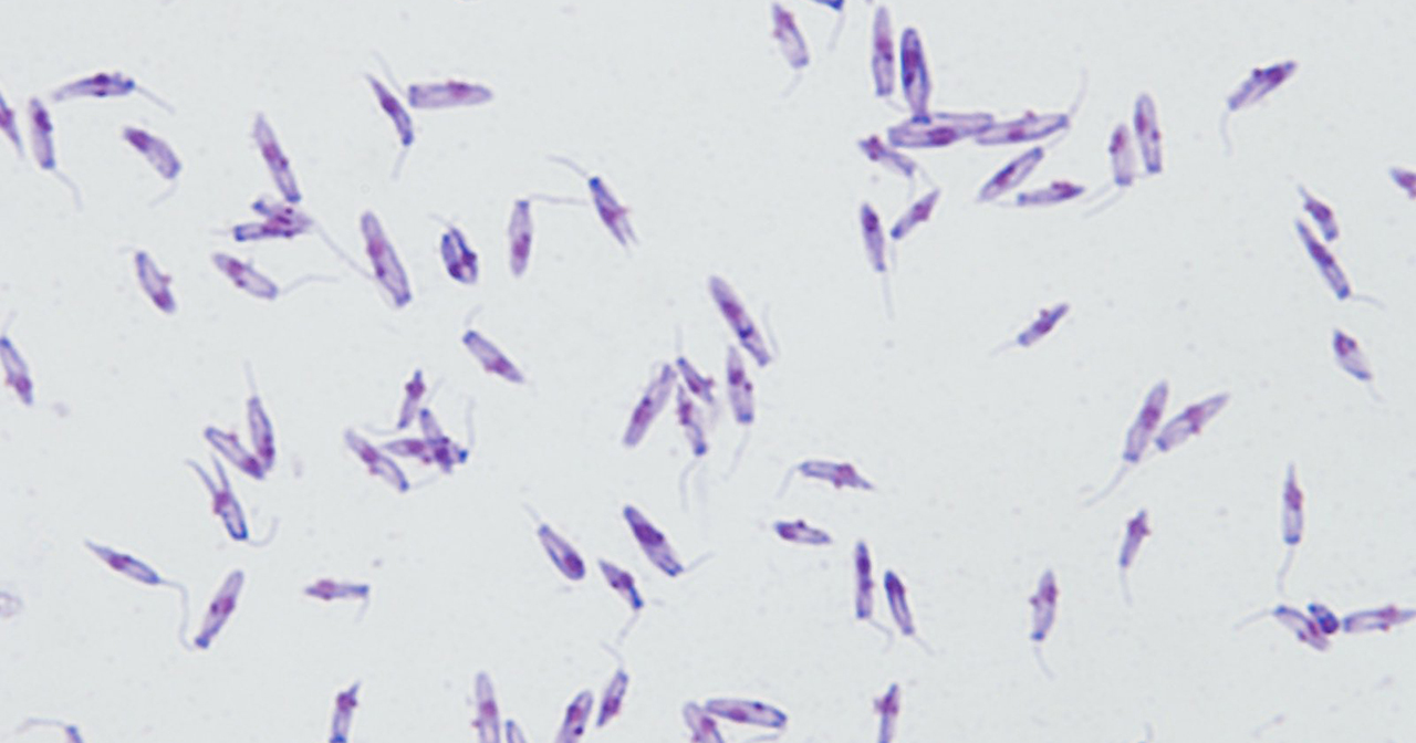 Microscopia mostra o parasita descoberto por pesquisadores da UFS, USP e UFSCar, que é semelhante ao gênero Leishmania (Foto: FMRP/USP)