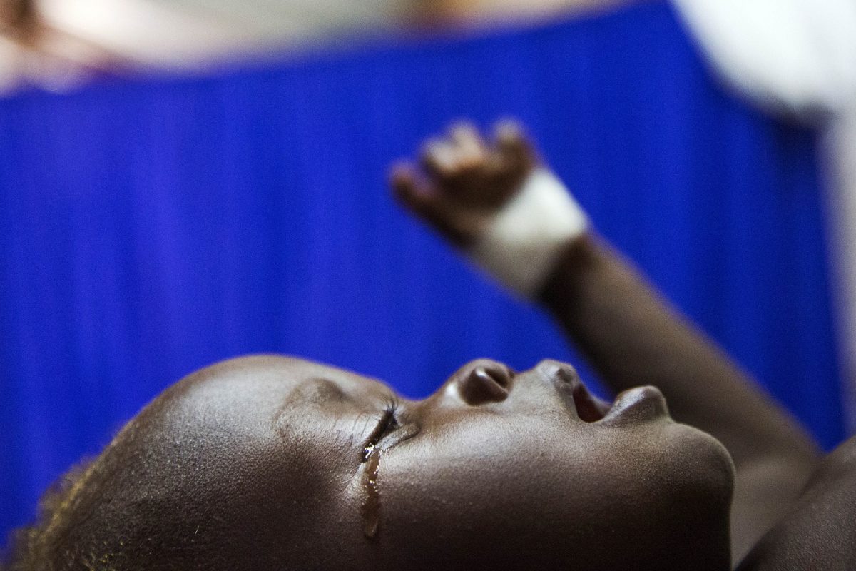 Achol Ri, tem cinco anos, vive no Sudão e sofre de desnutrição severa. Foto Albert Gonzalez Farran/AFP