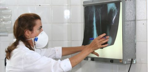 Dia Mundial de Combate à Tuberculose: número de casos no Brasil, que chegou a 63 mil em 2015, passou de 69 mil em 2017 para 76 mil em 2018 (Foto: Agecom Bahia)