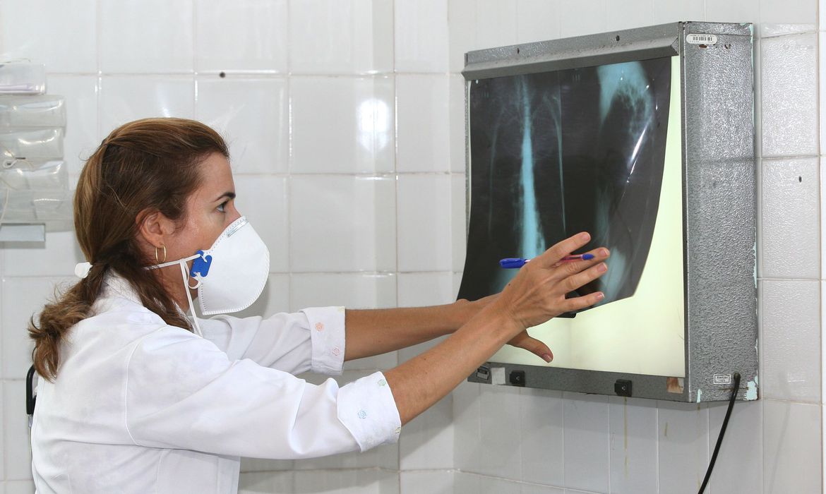 Dia Mundial de Combate à Tuberculose: número de casos no Brasil, que chegou a 63 mil em 2015, passou de 69 mil em 2017 para 76 mil em 2018 (Foto: Agecom Bahia)