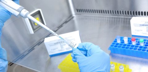No laboratório de Bio-Manguinhos, na Fiocruz, técnico trabalha com o kit de diagnóstico molecular para o coronavírus. Foto Imagens Fiocruz/Julho/2020