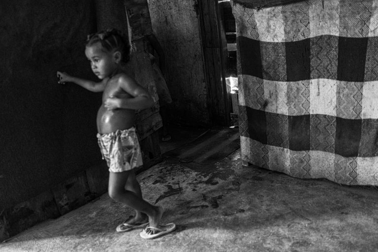 Fome em tempos de pandemia. Vivian da Silva Borges tem 23 anos e mora com os três filhos no Parque das Missões, em Caxias: "Já passei muitos perrengues, sem trabalho e sem comida, mas agora melhorou um pouco porque comecei a fazer trancinhas e consigo dinheiro pro pão, leite, mistura e carne". Foto João Roberto Ripper. Março/2021