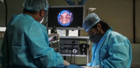 Médicos fazem cirurgia em paciente com mucormicose, fungo negro,, em Ghaziabad, na Índia: infecção que ataca milhares de indianos chegou ao Brasil (Foto: Pankaj Nangia / Anadolu Agency / AFP)