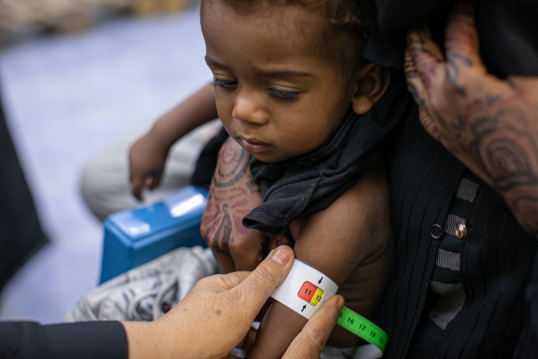 Basel tem seu braço medido para checar nível de desnutrição em Áden: mais de dois milhões de crianças subnutridas no Iêmen (Foto: PMA/ONU)