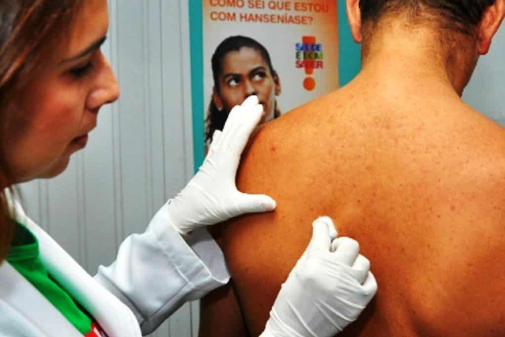 Exame durante campanha de combate à pandemia: pandemia levou à falta de medicamentos para a doença em 18 estados (Foto: Agência Brasil/Arquivo)