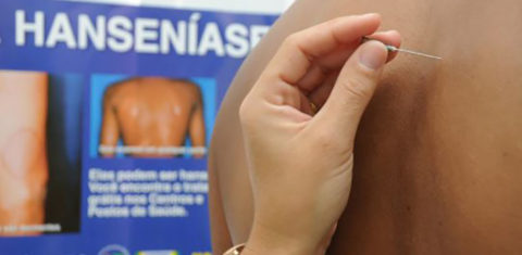Exame para identificação de hanseníase durante campanha no começo de 2020: Brasil teve 27 mil casos em 2019 (Foto: Adilson dos Santos/Governo do Tocantins)