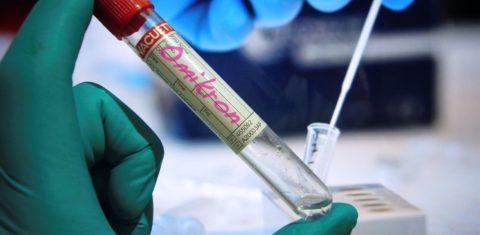 Teste para a variante Ômicron na Alemanha: para imunologista, esta pode ser a última variante "de preocupação" do nov o coronavírus (Foto: Frank Hoermann / Sven Simon / dpa / AFP)