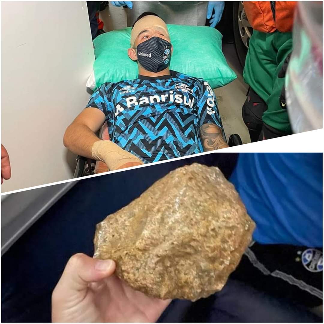 O volante Villasanti e a pedra que o feriu, no ataque ao ônibus do Grêmio, que provocou adiamento do Grenal 435. Reprodução do Twitter