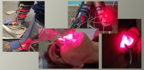 Aparelhos que combinam laser, ultrassom e pressão negativa ajudam a regenerar tecidos e tratar lesões musculares, articulares, neurológicas, dermatológicas e pulmonares provocadas pela covid-19 (Fotos: Cepof/Divulgação)