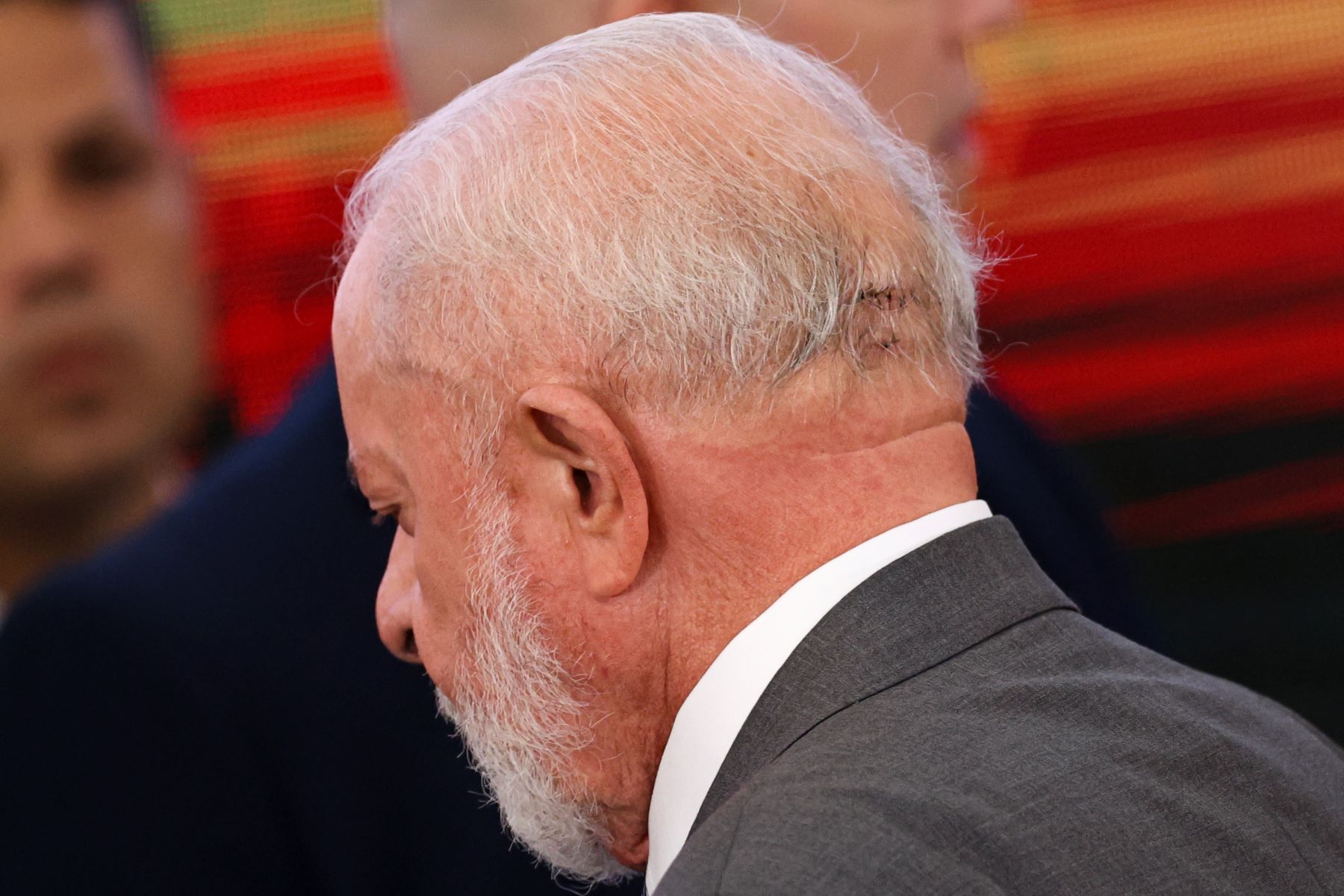 O presidente Lula, 79 anos, com pontos na cabeça após acidente doméstico, comuns com pessoas idosas: brasileiros com mais de 70 anos dificilmente conseguem contratar plano de saúde (Foto: Marcelo Camargo / Agência Brasil - 25/20/2024)